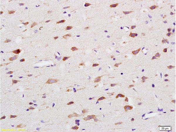 NADPH oxidase 4 Antibody in Immunohistochemistry (Paraffin) (IHC (P))
