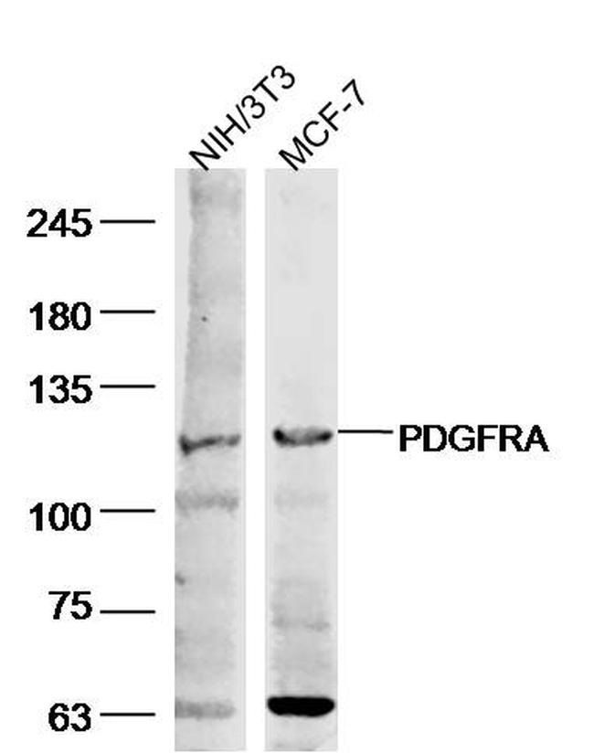 PDGFRA Antibody in Western Blot (WB)