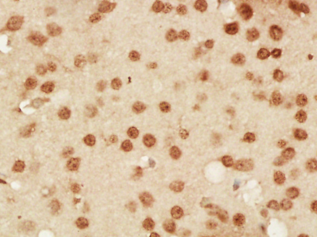 DNA PKcs Antibody in Immunohistochemistry (Paraffin) (IHC (P))