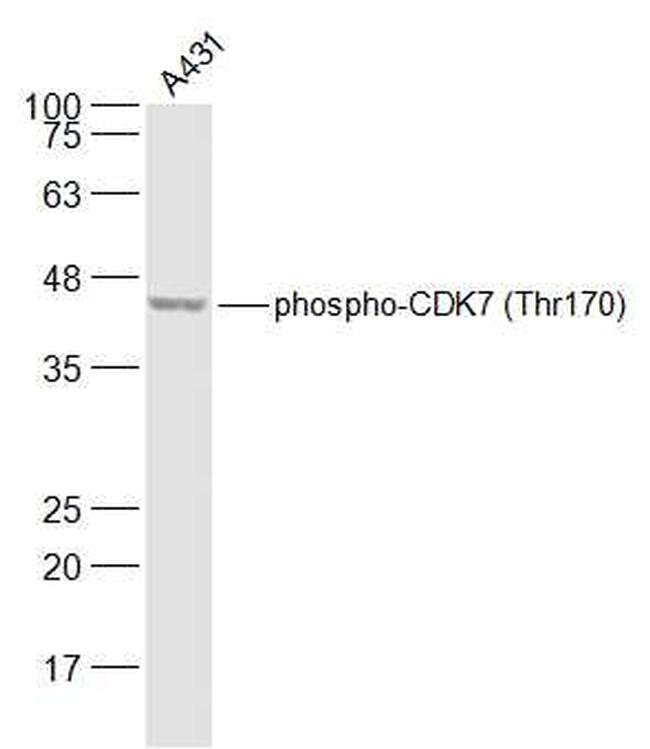Phospho-CDK7 (Thr170) Antibody in Western Blot (WB)