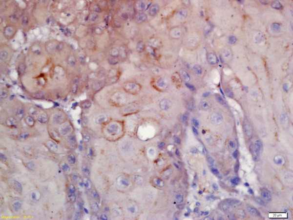 CD276/B7H3 Antibody in Immunohistochemistry (Paraffin) (IHC (P))
