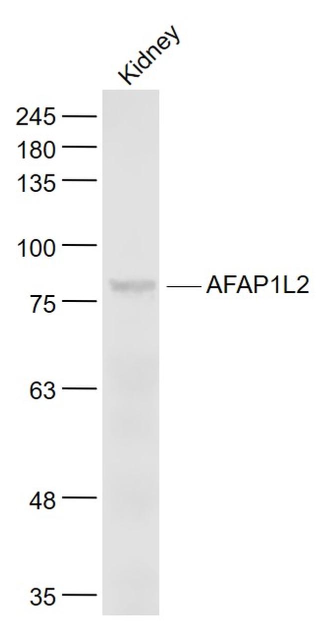 AFAP1L2 Antibody in Western Blot (WB)