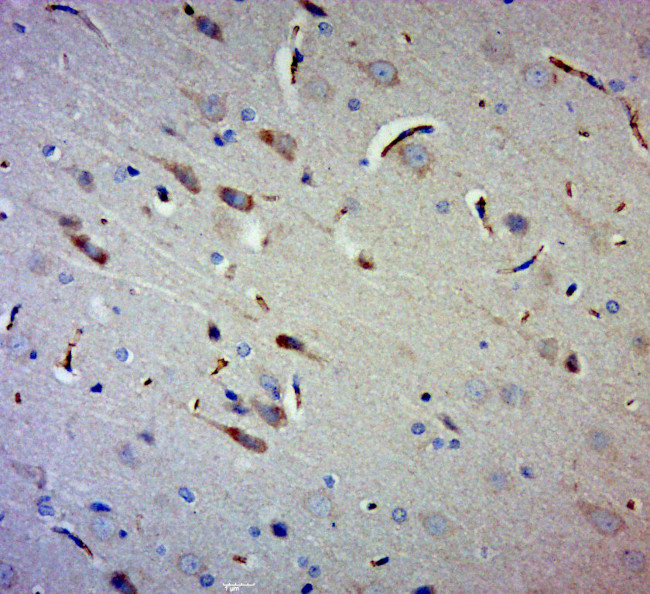 Gigaxonin Antibody in Immunohistochemistry (Paraffin) (IHC (P))