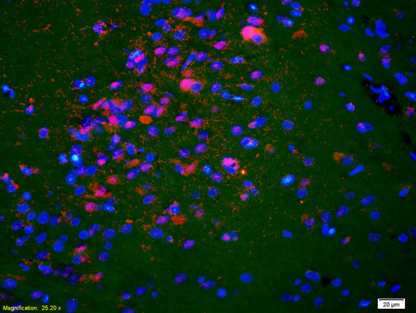 K5A/NKHC1 Antibody in Immunohistochemistry (Paraffin) (IHC (P))