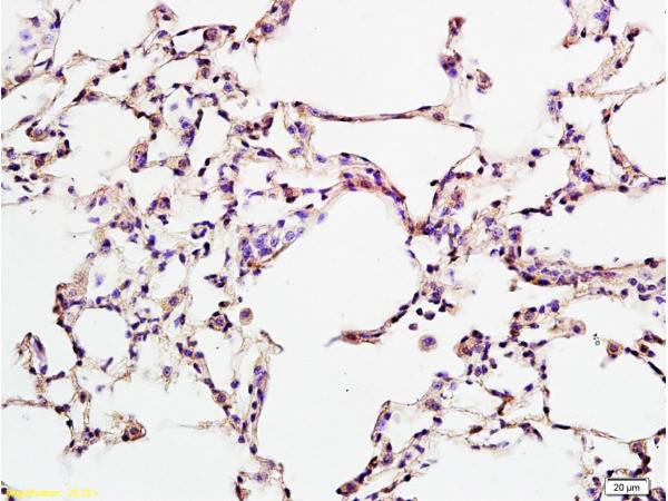 CD274 Antibody in Immunohistochemistry (Paraffin) (IHC (P))