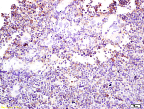 Phospho-DAB2 (Ser24) Antibody in Immunohistochemistry (Paraffin) (IHC (P))