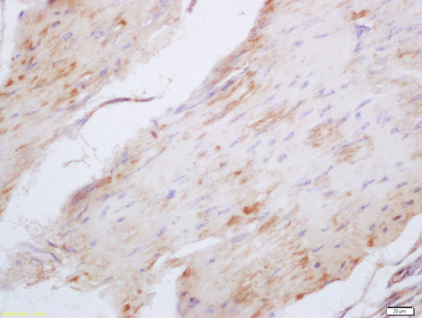 Elastin Antibody in Immunohistochemistry (Paraffin) (IHC (P))