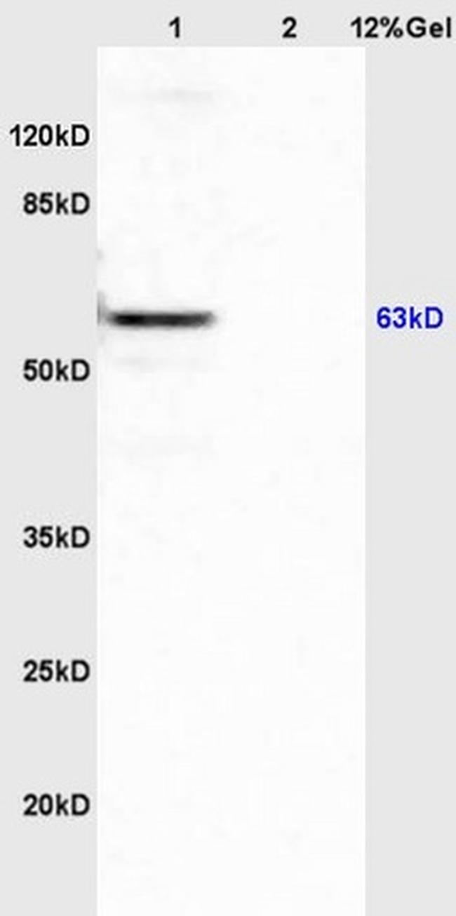 APBA3/Mint3/X11gamma Antibody in Western Blot (WB)