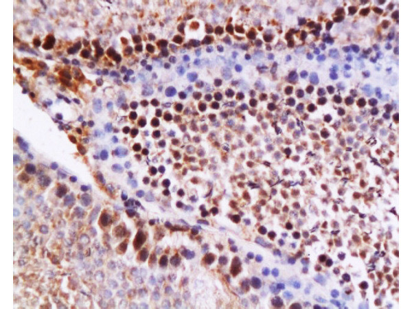 Caspase 12 Antibody in Immunohistochemistry (Paraffin) (IHC (P))