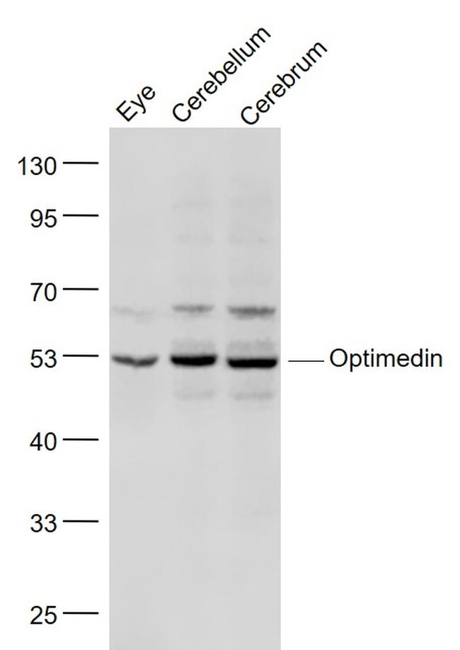 OLFM3/Optimedin Antibody in Western Blot (WB)