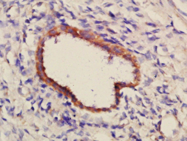 PCDH7 Antibody in Immunohistochemistry (Paraffin) (IHC (P))