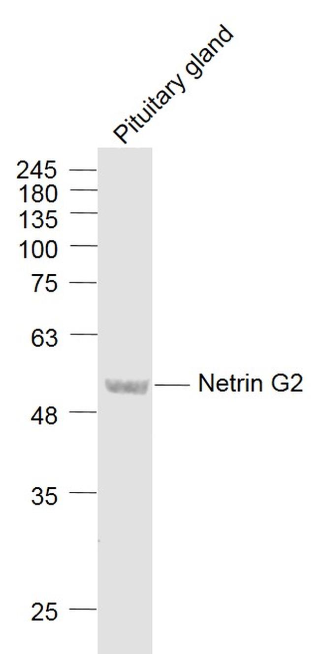 Netrin G2 Antibody in Western Blot (WB)