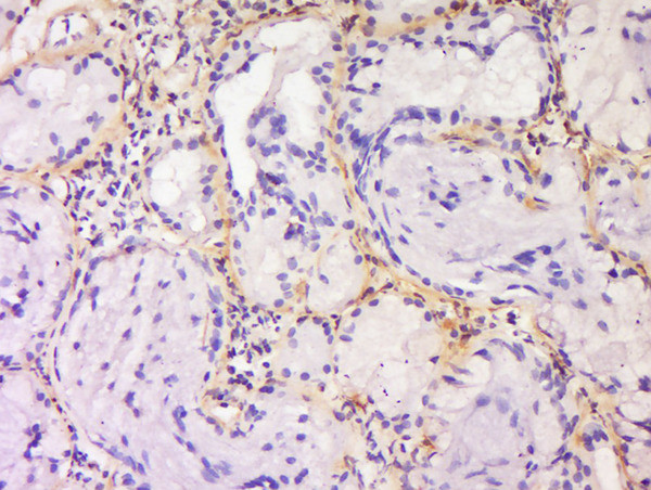 SPRR3/Cornin B Antibody in Immunohistochemistry (Paraffin) (IHC (P))