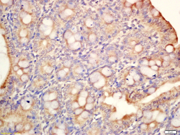 MAdCAM1 Antibody in Immunohistochemistry (Paraffin) (IHC (P))