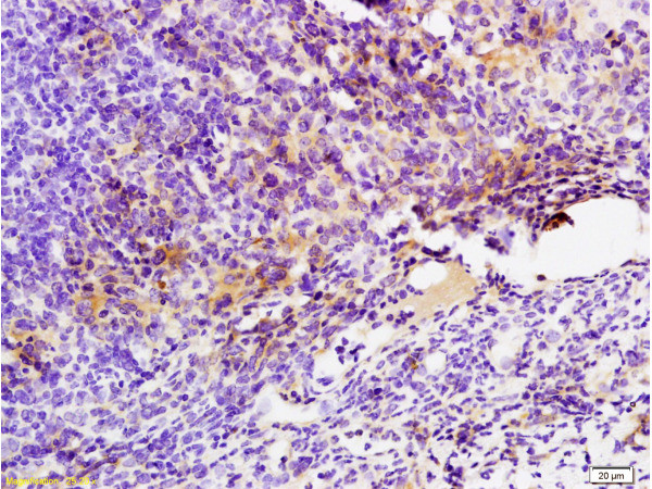 GPR49/LGR5 Antibody in Immunohistochemistry (Paraffin) (IHC (P))