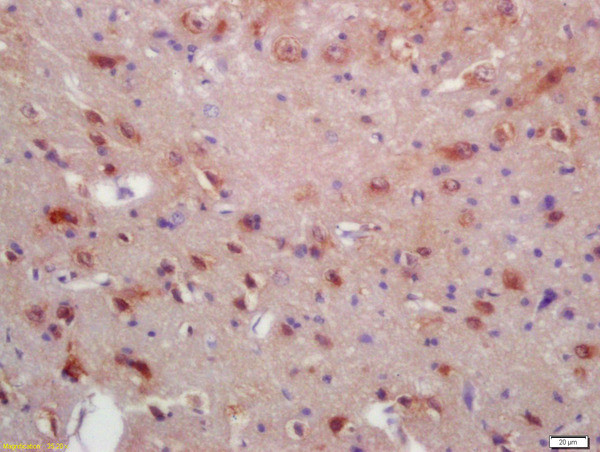 MYRF/C11orf9 Antibody in Immunohistochemistry (Paraffin) (IHC (P))