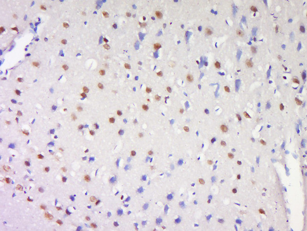 ProSAPiP1 Antibody in Immunohistochemistry (Paraffin) (IHC (P))