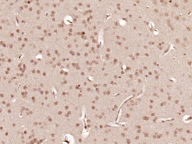 LHX2 Antibody in Immunohistochemistry (Paraffin) (IHC (P))