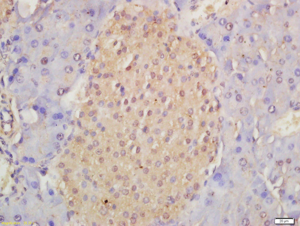 Musashi 1/2 Antibody in Immunohistochemistry (Paraffin) (IHC (P))