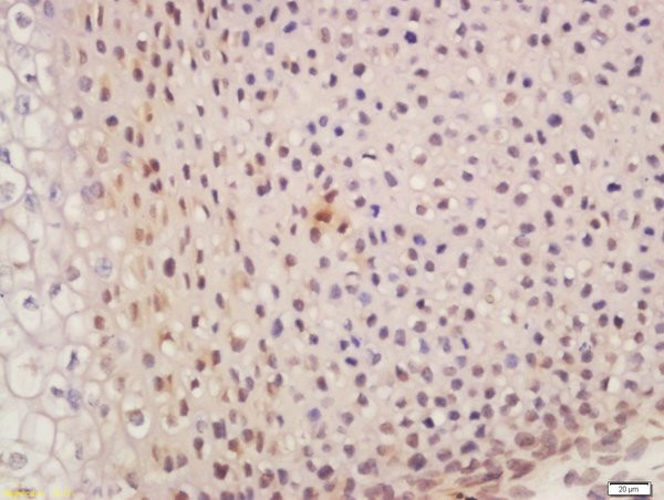SUFU/Suppressor of Fused Antibody in Immunohistochemistry (Paraffin) (IHC (P))