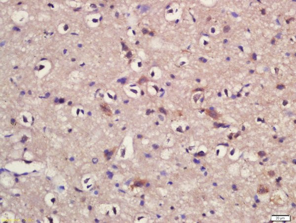 KLC1/KNS2 Antibody in Immunohistochemistry (Paraffin) (IHC (P))