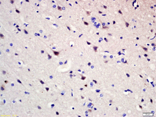 Pumilio 1 Antibody in Immunohistochemistry (Paraffin) (IHC (P))