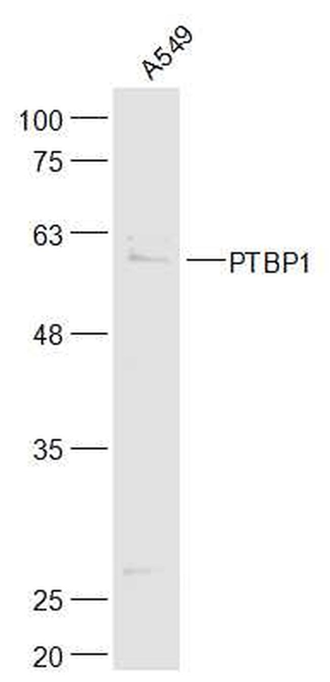 PTBP1 Antibody in Western Blot (WB)