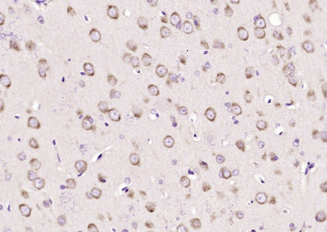 Sema3F/semaphorin 3F Antibody in Immunohistochemistry (Paraffin) (IHC (P))