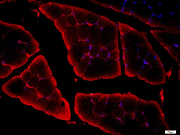 CACNA1F Antibody in Immunohistochemistry (Paraffin) (IHC (P))