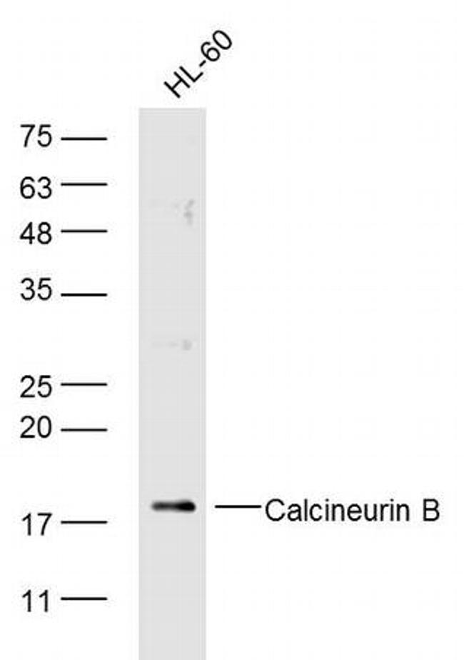 Calcineurin B/PP2B-B1 Antibody in Western Blot (WB)
