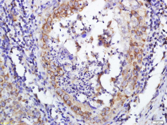 DERLIN-1 Antibody in Immunohistochemistry (Paraffin) (IHC (P))