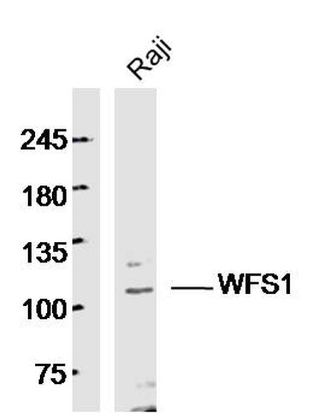 WFS1 Antibody in Western Blot (WB)
