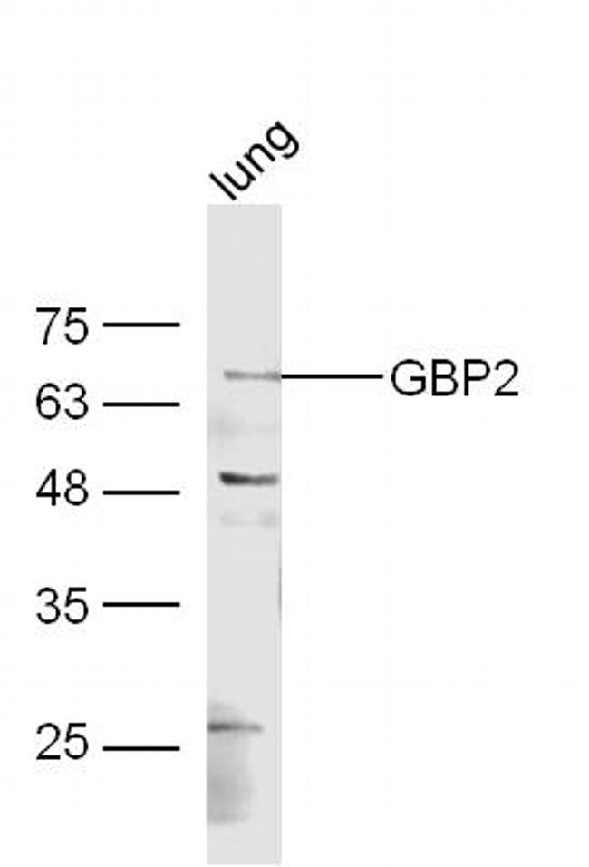 GBP2 Antibody in Western Blot (WB)