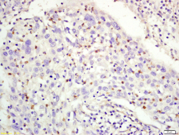 RFC1 Antibody in Immunohistochemistry (Paraffin) (IHC (P))