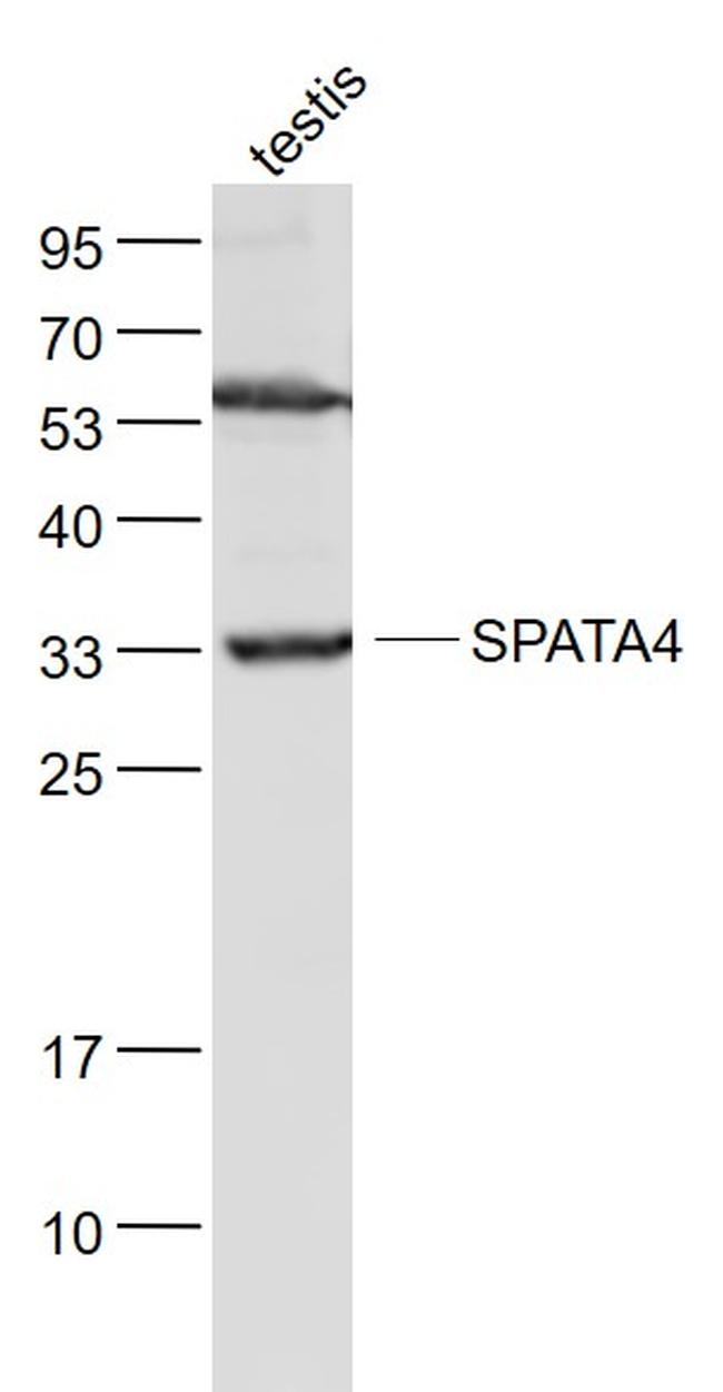 TSARG2 Antibody in Western Blot (WB)