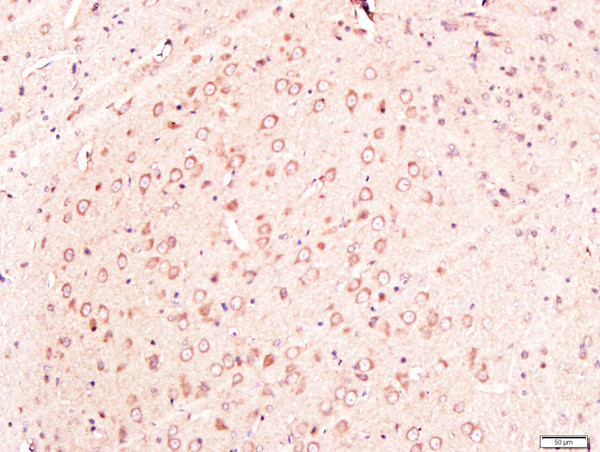 Neuroglycan C Antibody in Immunohistochemistry (Paraffin) (IHC (P))