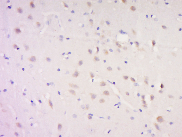 SNAP91/AP180 Antibody in Immunohistochemistry (Paraffin) (IHC (P))