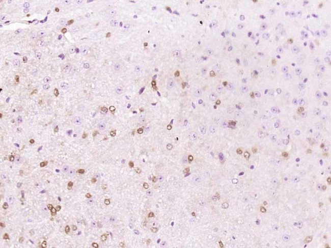 APBA1 Antibody in Immunohistochemistry (Paraffin) (IHC (P))