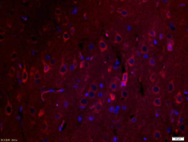 SPARC Antibody in Immunohistochemistry (Paraffin) (IHC (P))