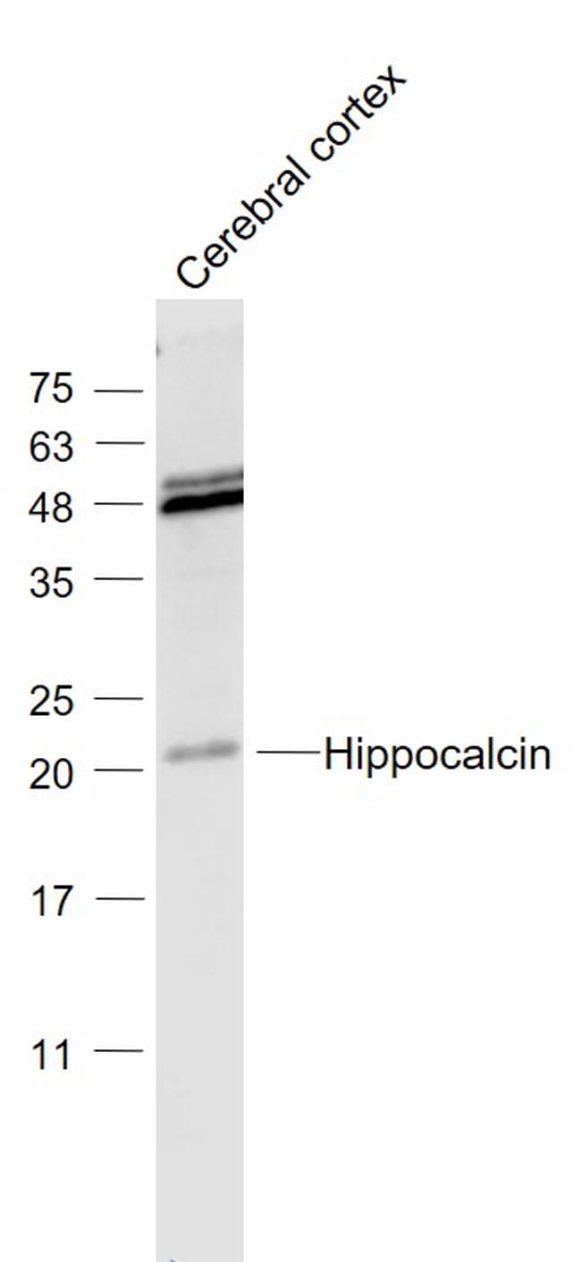 Hippocalcin Antibody in Western Blot (WB)