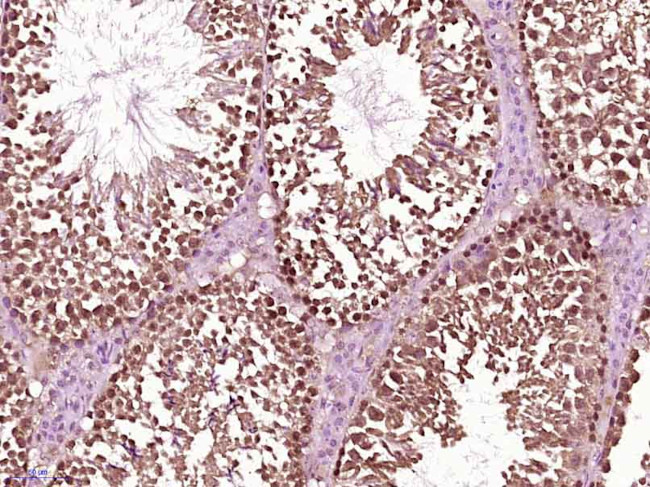 SRC Antibody in Immunohistochemistry (Paraffin) (IHC (P))