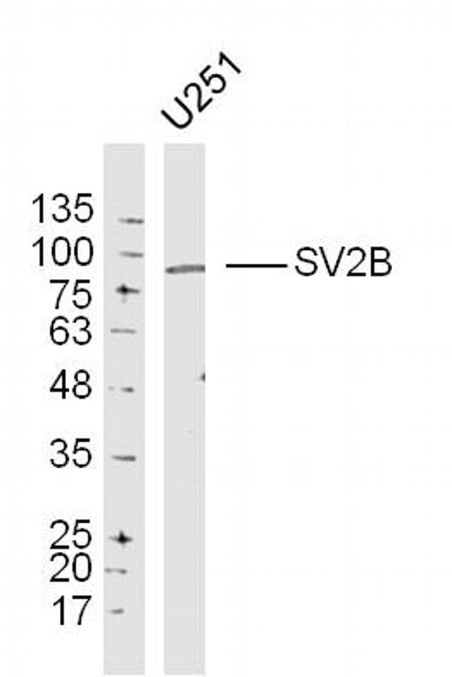 SV2B Antibody in Western Blot (WB)