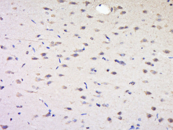 SYNPR/Synaptoporin Antibody in Immunohistochemistry (Paraffin) (IHC (P))