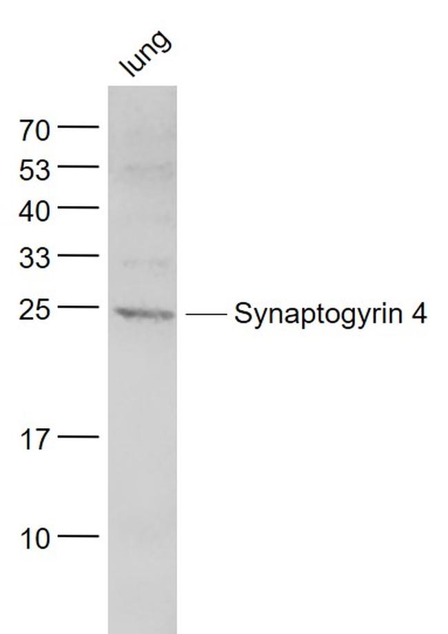 Synaptogyrin 4 Antibody in Western Blot (WB)
