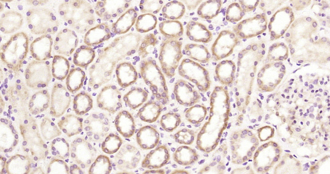 A2LD1/GGACT Antibody in Immunohistochemistry (Paraffin) (IHC (P))