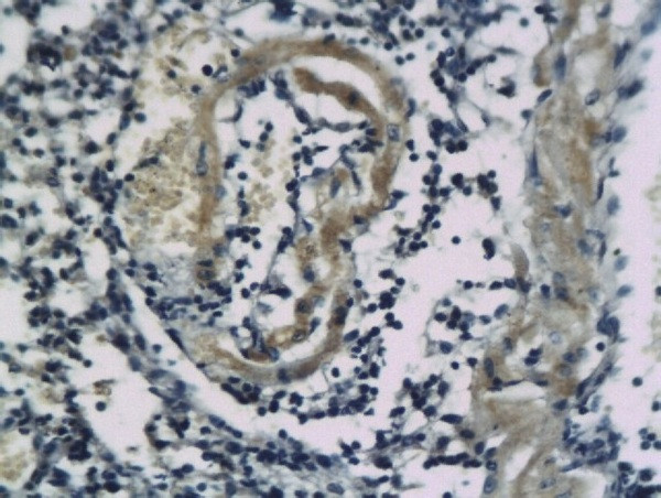 SSTR2/Somatostatin Receptor 2 Antibody in Immunohistochemistry (Paraffin) (IHC (P))