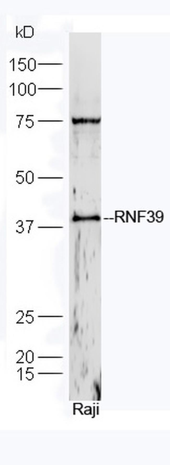 RNF39 Antibody in Western Blot (WB)