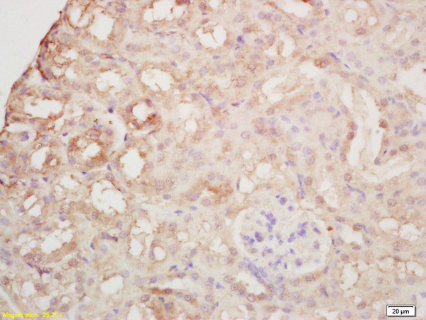 Arginase 2 Antibody in Immunohistochemistry (Paraffin) (IHC (P))