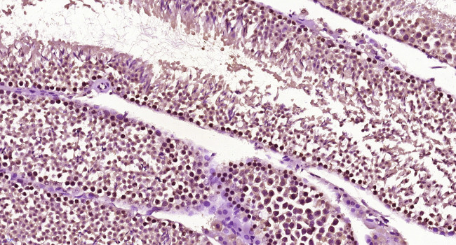 GCX1/C20orf100 Antibody in Immunohistochemistry (Paraffin) (IHC (P))