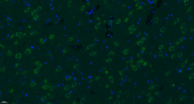 Progestin Receptor Beta/MPRB Antibody in Immunohistochemistry (Paraffin) (IHC (P))